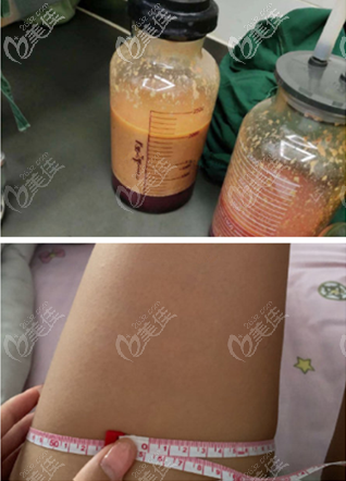 大腿細(xì)了好多了