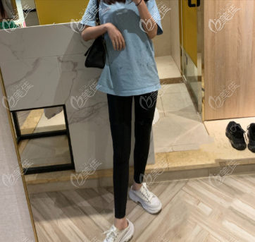 看過大腿抽脂失敗案例圖片的人別慌，參考下我在重慶好美的真實經(jīng)歷