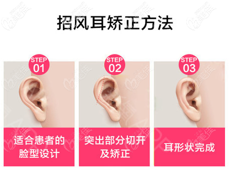 廣州高尚余文林醫(yī)生招風(fēng)耳矯正過程