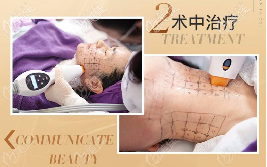 來廣州美萊做真的熱瑪吉手術(shù)過程