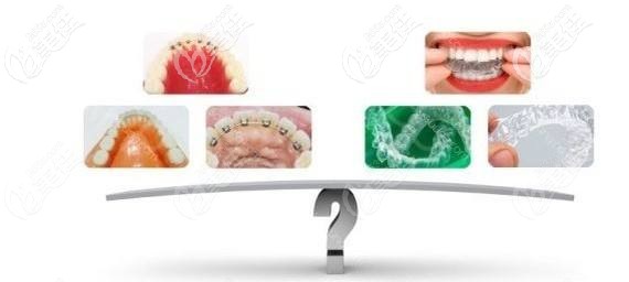 牙齒矯正的各種方式 牙齒矯正的各種方式