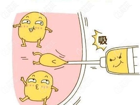 在北海做腰腹吸脂的費(fèi)用