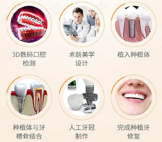 南寧牙百年口腔黃干醫(yī)生做種植牙怎么樣 南寧牙百年口腔黃干醫(yī)生做種植牙怎么樣