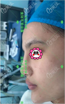 在北京美憬做鼻綜合修復(fù)前 在北京美憬做鼻綜合修復(fù)前