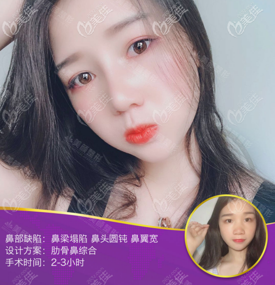 深圳美顏醫(yī)療美容怎么樣？不妨來看看林仕錦院長做的案例