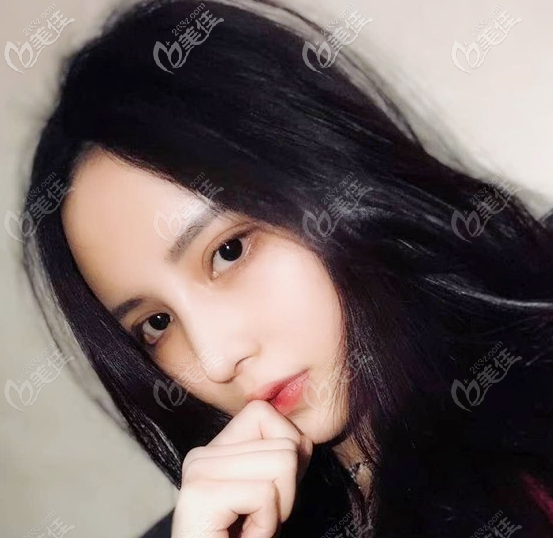 看了那么多鼻整形案例,只有廣州韓妃阿芙洛美鼻讓我心動(dòng)