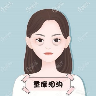 明顯的淚溝該怎么辦