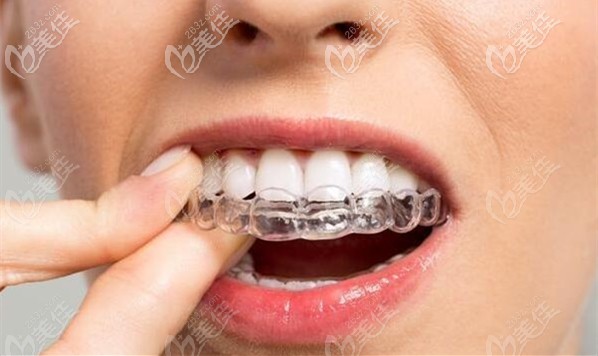 佛山拜爾口腔的牙齒正畸優(yōu)惠價(jià)格介紹