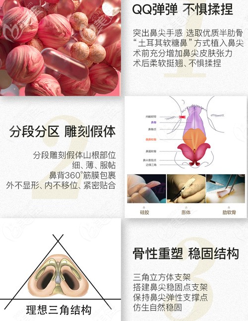 <!--<i data=20240703-sp></i>-->軟糖鼻的優(yōu)勢