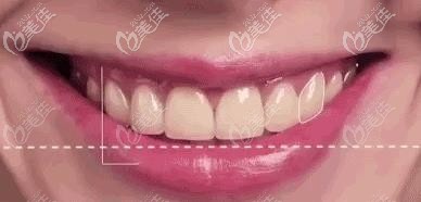 微笑曲線 微笑曲線