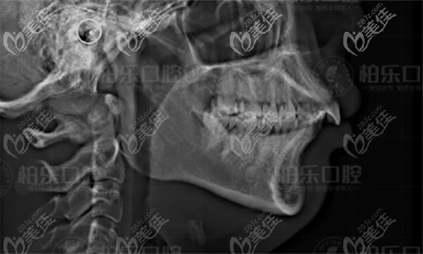 在南寧柏樂拍牙齒片 在南寧柏樂拍牙齒片