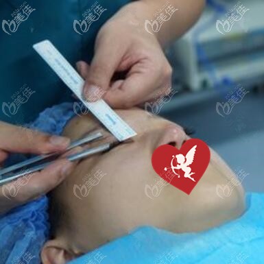 做埋線雙眼皮術(shù)前畫線設(shè)計(jì) 做埋線雙眼皮術(shù)前畫線設(shè)計(jì)