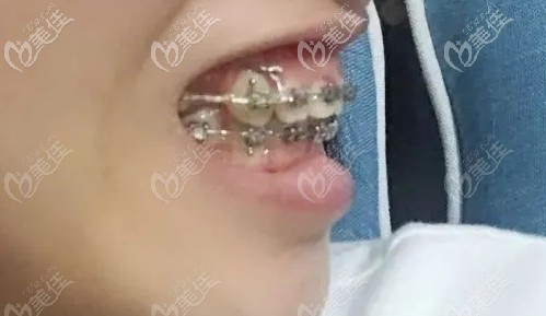 速度太快了，已經(jīng)沒(méi)有那么凸了