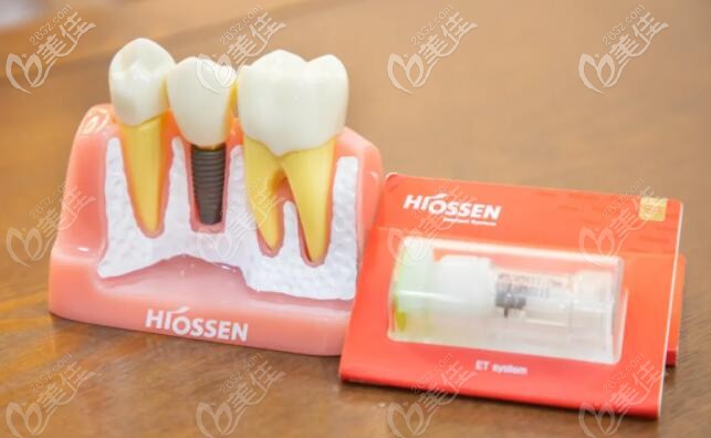 羅緣口腔孫主任擅長做美國皓圣種植牙