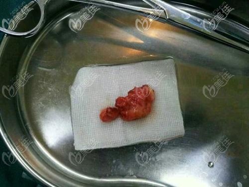 取出的生長因子