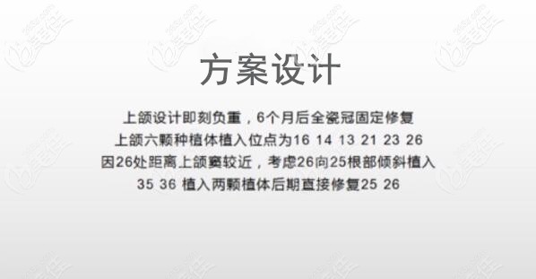 上半口ALL-ON-6即刻負(fù)重種植牙方案 上半口ALL-ON-6即刻負(fù)重種植牙方案