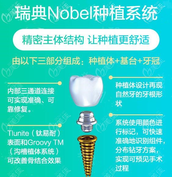 瑞典諾貝爾種植牙的優(yōu)勢(shì)