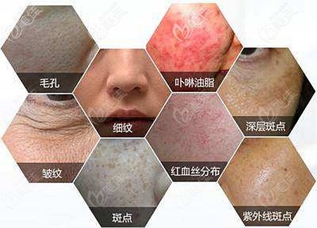 崔光靜醫(yī)生解析常見的皮膚問題 崔光靜醫(yī)生解析常見的皮膚問題