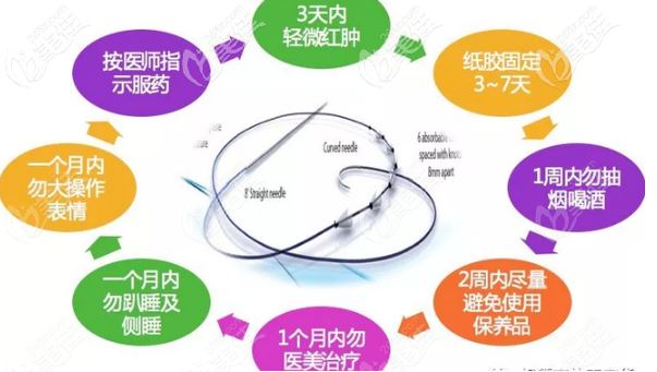 鈴鐺線的注意事項(xiàng)