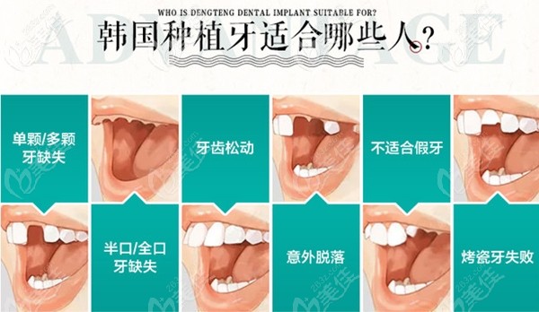 適合做種植牙的人群