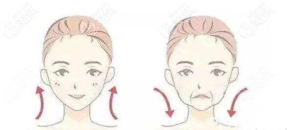 衰老型法令紋呈現(xiàn)的效果