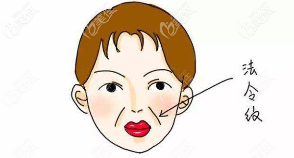 面部出現(xiàn)深重的法令紋