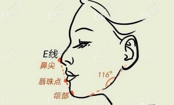 二類(lèi)骨性齙牙矯正的標(biāo)準(zhǔn) 二類(lèi)骨性齙牙矯正的標(biāo)準(zhǔn)