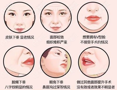 面部埋線提升可以改善的問題