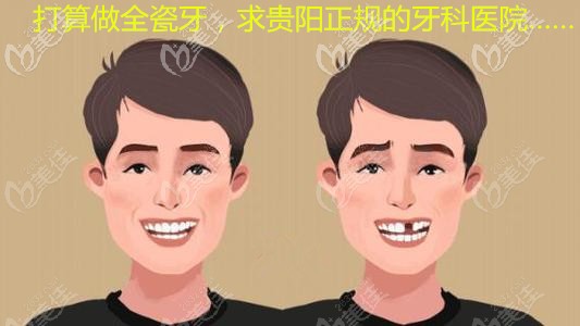 貴陽南明區(qū)丁澤鯉口腔做一顆愛爾創(chuàng)魅影全瓷牙要2200貴嗎