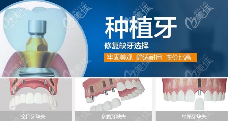 邛崍新橋口腔種植牙怎么樣 邛崍新橋口腔種植牙怎么樣