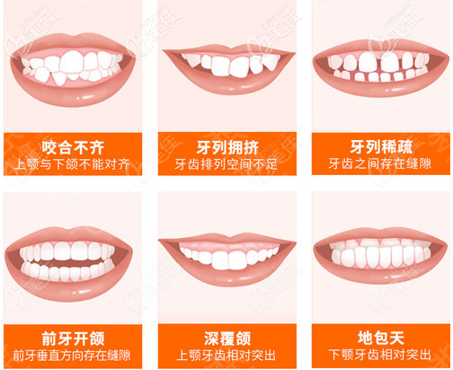 北京壹加壹牙科張建朋擅長牙齒矯正