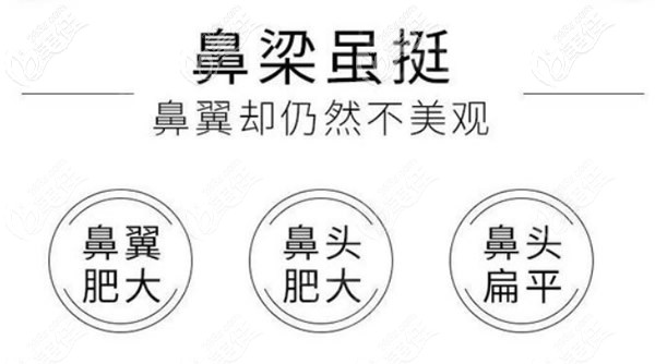 手術縮鼻翼適應的人群 手術縮鼻翼適應的人群