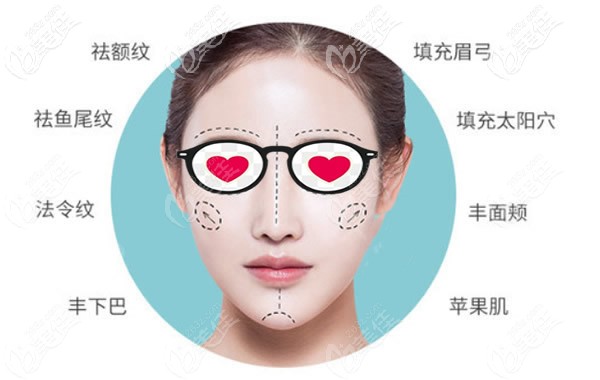 玻尿酸填充全臉的部位 玻尿酸填充全臉的部位
