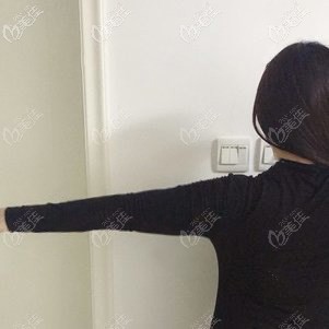 胳膊吸脂術(shù)后7天依舊腫脹 胳膊吸脂術(shù)后7天依舊腫脹