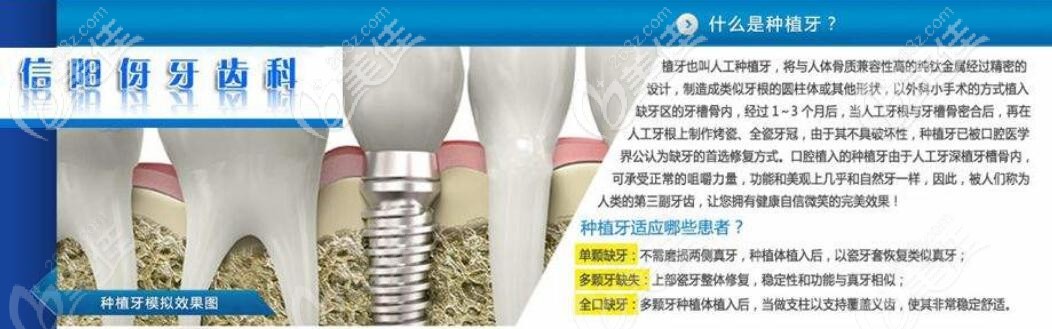 信陽伢牙齒科種植牙介紹