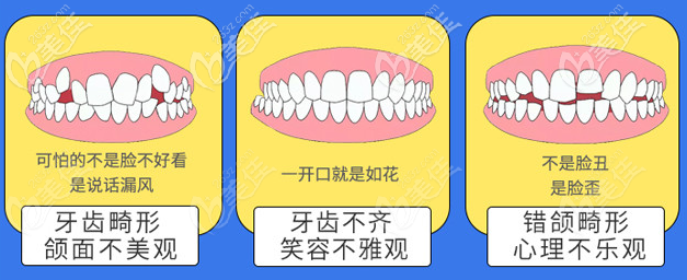 北京壹加壹口腔擅長(zhǎng)各種牙齒畸形矯正 北京壹加壹口腔擅長(zhǎng)各種牙齒畸形矯正