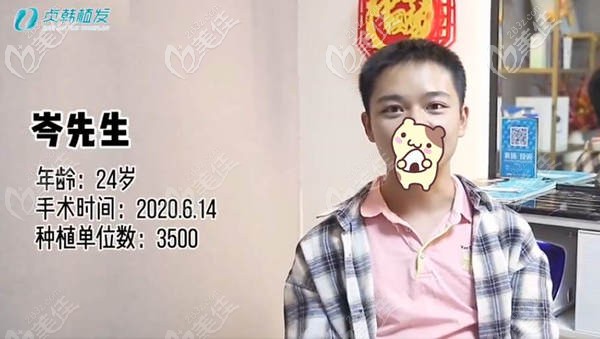 玉林貞韓發(fā)際線種植3500毛囊術(shù)后效果圖 玉林貞韓發(fā)際線種植3500毛囊術(shù)后效果圖