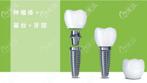 江醫(yī)生擅長牙齒缺失種植 江醫(yī)生擅長牙齒缺失種植