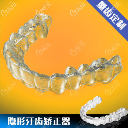 牙齒隱形矯正器 牙齒隱形矯正器
