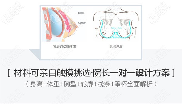正品的曼托隆胸假體材料+院長精細手術(shù)