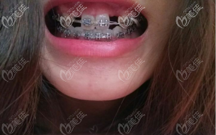 兩年多那會(huì)兒 兩年多那會(huì)兒