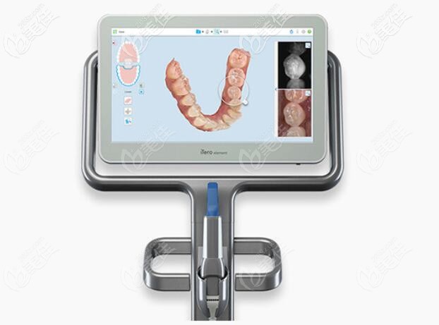 全隱形牙齒矯正3D掃描數(shù)字化<span style= 全隱形牙齒矯正3D掃描數(shù)字化<span style=