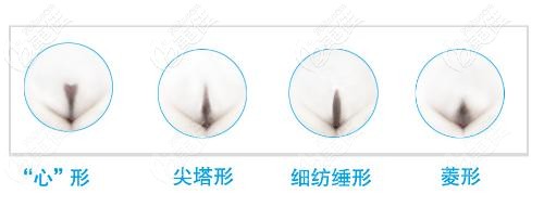 比基尼部位的毛發(fā)