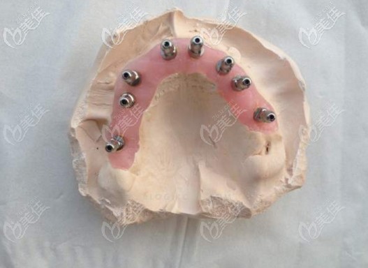 已經(jīng)生產(chǎn)好的導(dǎo)板