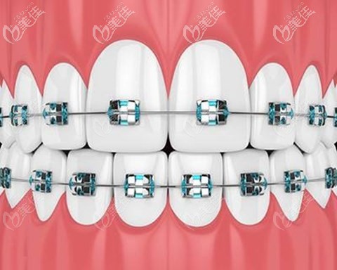 徐洋醫(yī)生牙齒正畸矯正優(yōu)勢(shì)