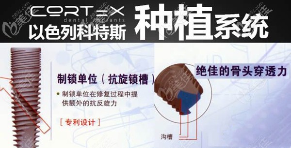 以色列科特斯種植體怎么樣