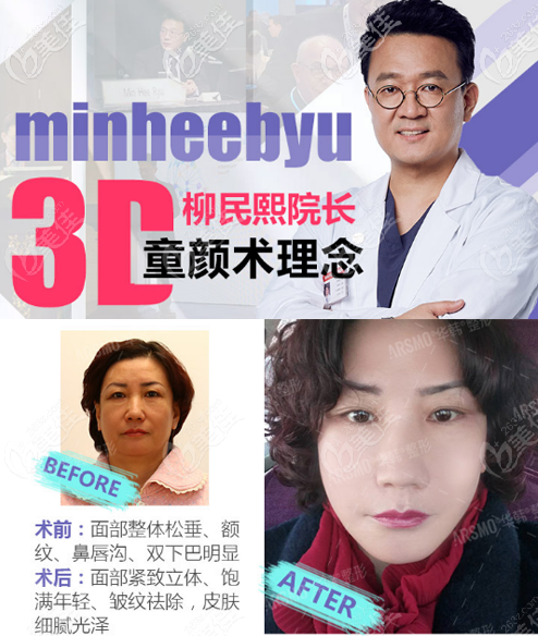 北京華韓柳民熙做拉皮怎么樣