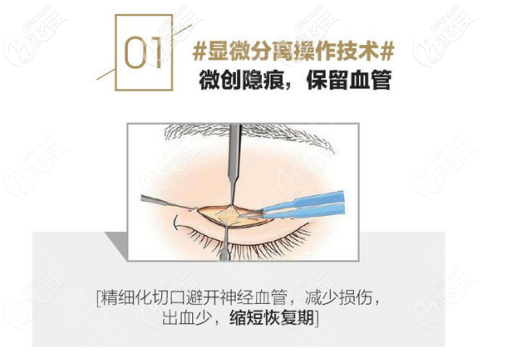 朱建瑩眼部整形縫合技術(shù) 朱建瑩眼部整形縫合技術(shù)