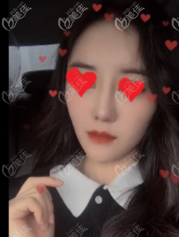 正正的鼻梁 正正的鼻梁