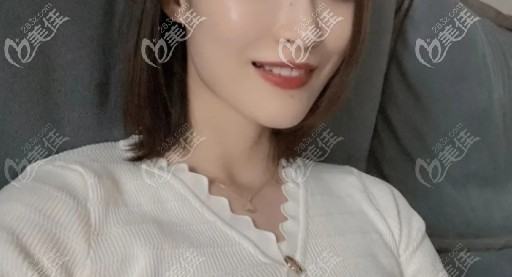 分享一波我在杭州美萊口腔戴鋼絲固定牙套改變上牙前凸的正畸案例，是拔牙矯正哦！